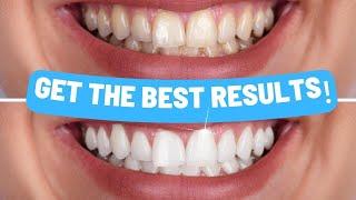 The Ultimate Teeth Whitening Guide | Step-by-Step Instructions for Home Whitening Kits