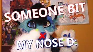 SOMEONE BIT MY NOSE!