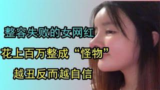 整容失敗的女網紅，花上百萬整成「怪物」，越醜反而越自信