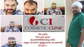 Hair Transplant Kochi Kerala | Cutis international Dermatology & cosmetic Center Ernakulam