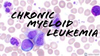 Chronic Myeloid Leukemia (CML) Peripheral Blood Smear (Hematopathology & Hematology)