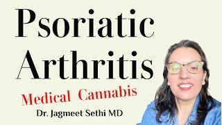 Top Cannabinoids for Psoriatic Arthritis. Based on 15,000 Patients, 40,000 Visits by a doctor.