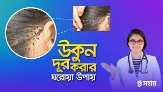 মাত্র ১ দিনেই উকুন দূর করার উপায় — ডা. তাসনিম জারা (চিকিৎসক, ইংল্যান্ড)