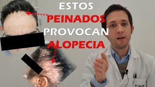 DOCTOR te cuenta PEINADOS que dan ALOPECIA