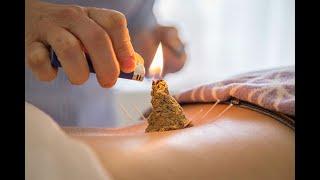 Moxibustion - A Traditional Chinese Medicine Approach to Improve Qi Flow (3 Minutes Microlearning)