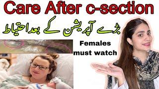 Top 5 Care Tips for Fast Recovery after c section | Healing process after cesarean | By dr.Bushra