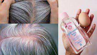 Gray hair turns black naturally permanently | From white hair to black hair in medicine