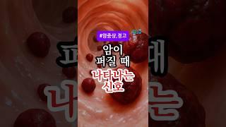 암이 퍼질 때 나타나는 신호 5가지, 절대 무시하지 마세요! #건강정보 #건강