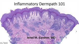 Inflammatory Dermpath 101 (A Beginner's Guide to Diagnosing Skin Rashes for Non-Dermatopathologists)