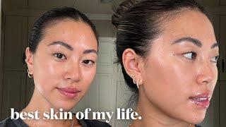 my unsponsored skincare routine for acne prone skin 