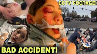 FOOTAGE of Nidal Wonder SCOOTER CRASH ACCIDENT?!  (TERRIBLE CAR ACCIDENT EXPLAINED)