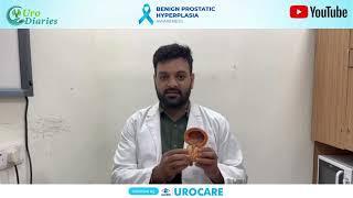 URO DIARIES Dr Puneet Bansal Delhi