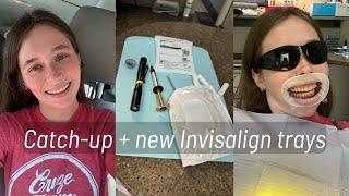 DAY IN THE LIFE: catching up, major Invisalign update, new trays?