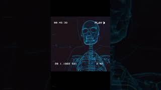 X Ray Transformation #shorts