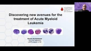Discovering new avenues for the treatment of Acute Myeloid Leukemia