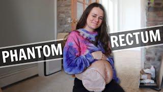 This is the Most Severe Phantom Rectum Has Been... | 30 Weeks Pregnant | Let's Talk IBD