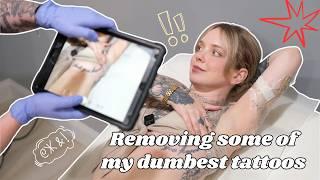 Removing MULTIPLE tattoos (and some of my dumbest) at Atlantic Laser in Virginia Beach
