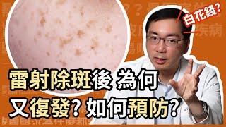 雷射除斑後，如何預防斑又復發？皮膚科林政賢醫師教大家打造不易長斑體質！