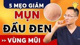 Chỉ bằng 5 mẹo đơn giản này giúp giảm mụn đầu đen-se khít lỗ chân lông vùng mũi nhanh chóng| Dr Hiếu