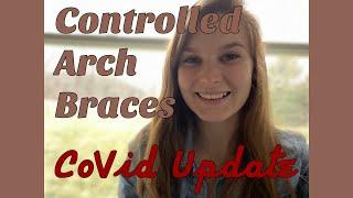 CoVid Quarantine Treatment Update | Controlled Arch Braces | My Treatment