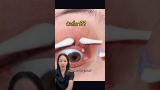 ตากุ้งยิง #หมอหลิน #จักษุแพทย์ #หมอตา#โรคตา#สารพัดเรื่องตา#ตากุ้งยิง#ต่อมไขมันเปลือกตาอุดตัน#ตาแห้ง