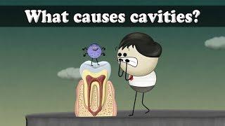 What causes cavities? | #aumsum #kids #science #education #children