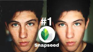 How to remove pimples from your face by Snapseed App FW Pictures| Snapseed Photo Editing #1