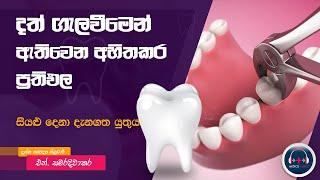 මුඛ සෞඛ්‍ය රැක ගනිමු (  3  ) දත් ගැලවීමෙන් වන ප්‍රතිවිපාක