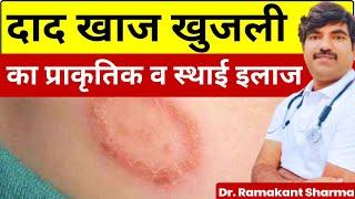 दाद, खाज, खुजली से छुटकारा पाएं | fungal skin infection@dr.ramakantsharma7