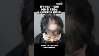 현직미용사가 극찬한 더제이비 두피문신 여성윗머리 전체 탈모커버