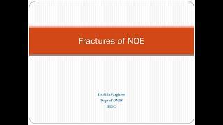 NOE fracture