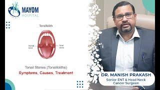 Tonsil Stones (Tonsilloliths) | Causes and Treatment | Dr. Manish Prakash