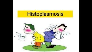 Histoplasmosis| chronic Fugal infections