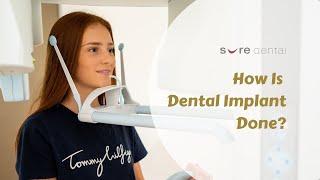 Dental Implant Procedure with Sure Dental