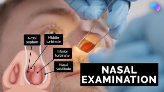 Nasal Examination | Nose Examination | OSCE Guide | UKMLA | CPSA
