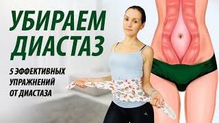 Избавляемся от диастаза. Как убрать диастаз за месяц.