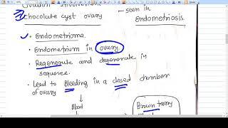 Chocolate cyst of ovary - Endometrioma