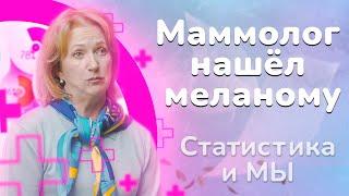 10 лет с диагнозом: меланома кожи. Ремиссия. Динара Богданова: «рак - это не приговор».