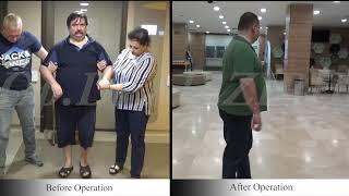 Ender KAVAS / Before and After Surgery Parkinson's Treatment DBS in Turkey