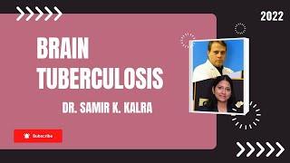 स्वास्थ्य संवाद Dr. Samir K Kalra के साथ  - India Top Doctor