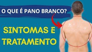 O que é “Pano Branco”? Sintomas e tratamento