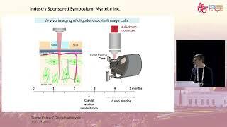 Myrtelle ASGCT Symposium Presentations