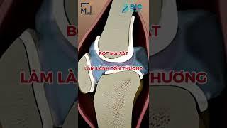 BẬT MÍ PHƯƠNG PHÁP ĐIỀU TRỊ THOÁI HÓA KHỚP GỐI HIỆU QUẢ | BÁC SĨ TRẦN MINH