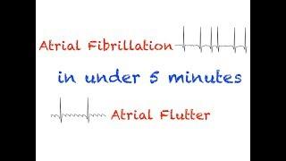 AFib and AFlutter Interpretation Under 5 minutes