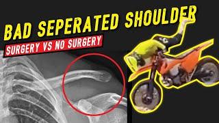 Enduro Crash Separated Shoulder Grade 5: Surgery vs No Surgery