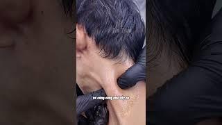 Ùa tai, đau đầu Đau nhấc cả đầu lên thì phải làm sao #utai #daudau #dauvai #tintam #daulung