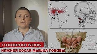 Головная боль | СИНДРОМ НИЖНЕЙ КОСОЙ МЫШЦЫ ГОЛОВЫ | Obliquus Capitis Inferior