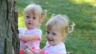 Conjoined Twins Learn to Live Apart