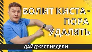 КИСТА И ПОТЕРЯ ЧУВСТВИТЕЛЬНОСТИ ПОСЛЕ ОПЕРАЦИИ