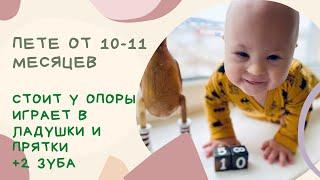 ПЕТЕ ОТ 10-11 МЕСЯЦЕВ. СТОИТ, ИГРАЕТ В ЛАДУШКИ. РАЗВИТИЕ МАЛЫША С СИНДРОМОМ ДАУНА. СТОИТ У ОПОРЫ.